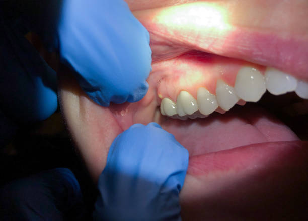 Best Broken Tooth Emergency  in Flower Hill, NY