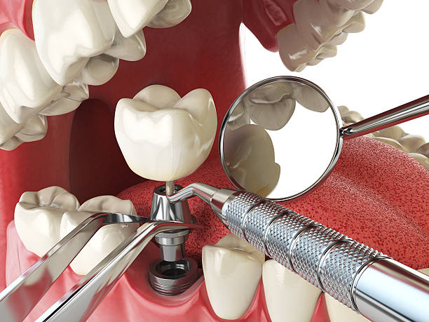 Best Cracked Tooth Emergency Dentist  in Flower Hill, NY